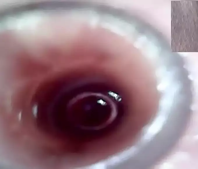 Unleash Your Pleasure with Lesbian Extreme Cervix Play and Peehole Fucking Penis Dildo