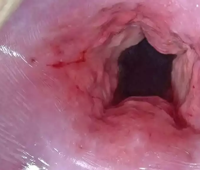 Experience the Sensual Art of Japanese Cervix Stretching and Uterus Dilation with Penetration: Unleash Your Desires and Unlock the Ultimate Pleasure!