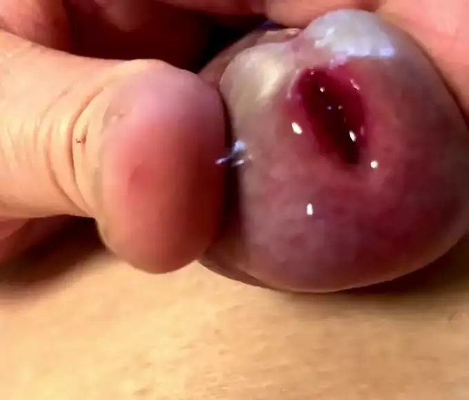 Unveiling The Erotic Beauty Of The G-Spot: Exploring The Glans Penis